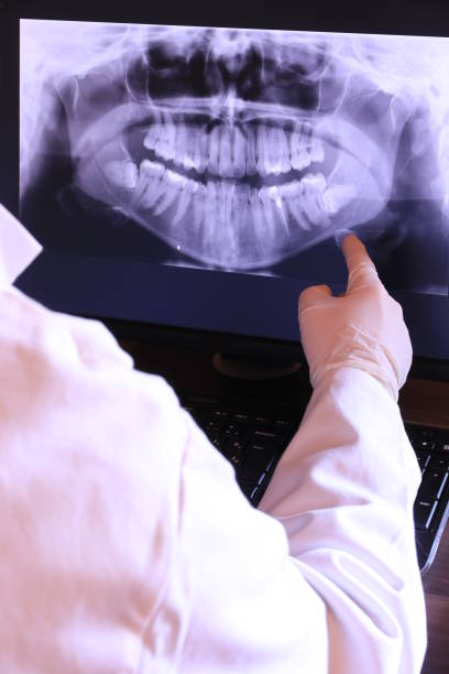 Best Dental Abscess Treatment in Flemingsburg, KY